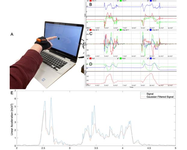 BioMarin暂停骨骼疾病疗法的中期临床试验